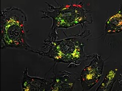 Grazie agli acidi nucleici sferici, il composto 5-fluorouracile è risultato 20.000 volte più efficace del solito negli studi sugli animali. (Fonte: Northwestern University)
