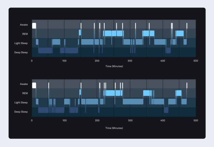 Il nuovo algoritmo di stadiazione del sonno di Oura (in basso) ha dimostrato un'accuratezza dell'84% rispetto alla polisonnografia (in alto). (Fonte: Oura)