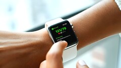 Apple Watch 11 e Apple Watch Ultra 3 potrebbero offrire il rilevamento della pressione sanguigna, e si prevede una riprogettazione importante a partire da Apple Watch 12. (Fonte: Qardio)