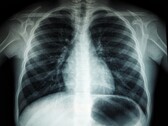 Un'immagine a raggi X di un torso umano (Fonte immagine: Umanoide via Unsplash; ritagliata)
