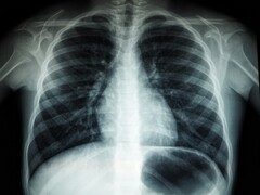 Un&#039;immagine a raggi X di un torso umano (Fonte immagine: Umanoide via Unsplash; ritagliata)