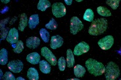 Un&#039;immagine che mostra le cellule staminali ottenute dalla pelle di una donna (Fonte immagine: UCLA via CIRM)