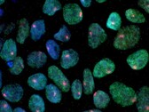 Un'immagine che mostra le cellule staminali ottenute dalla pelle di una donna (Fonte immagine: UCLA via CIRM)