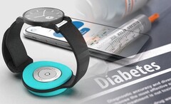Il sensore di glucosio nel sangue di Afon è un dispositivo indossabile che può essere collegato a un cinturino smartwatch adattato (fonte: Afon - modifica)