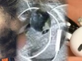 L'esplosione fatale degli auricolari è l'ultimo scioccante fallimento di un dispositivo che coinvolge apparecchiature audio personali. (Fonte immagine: Neowin/Times of India/WFLA - modificato)