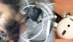 L'esplosione fatale degli auricolari è l'ultimo scioccante fallimento di un dispositivo che coinvolge apparecchiature audio personali. (Fonte immagine: Neowin/Times of India/WFLA - modificato)