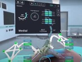 L'interfaccia di STELLAR Knee che visualizza le dimensioni e le posizioni calcolate delle ossa della gamba durante l'intervento al ginocchio. (Fonte: PolarisAR su Youtube)