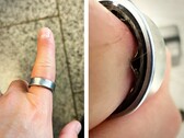 Un Samsung Galaxy Ring con una batteria gonfia ha costretto un utente a recarsi in ospedale. (Fonte: Zone of Tech)