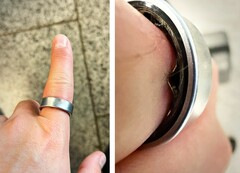 Un Samsung Galaxy Ring con una batteria gonfia ha costretto un utente a recarsi in ospedale. (Fonte: Zone of Tech)