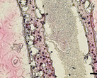 Scienziati canadesi stampano in 3D tubi di cellule testicolari funzionanti come precursore di nuovi trattamenti per l'infertilità