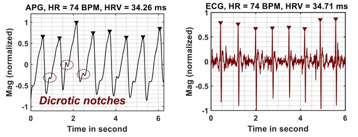 Le letture APG si confrontano positivamente con quelle dell'ECG (Fonte: Google Research)