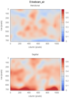 Distribuzione della risoluzione