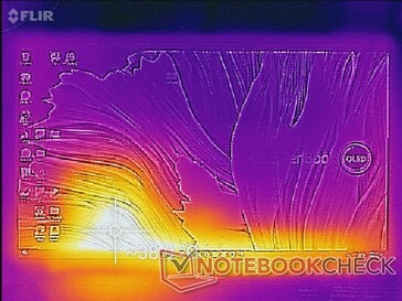 Mappa della temperatura (anteriore)