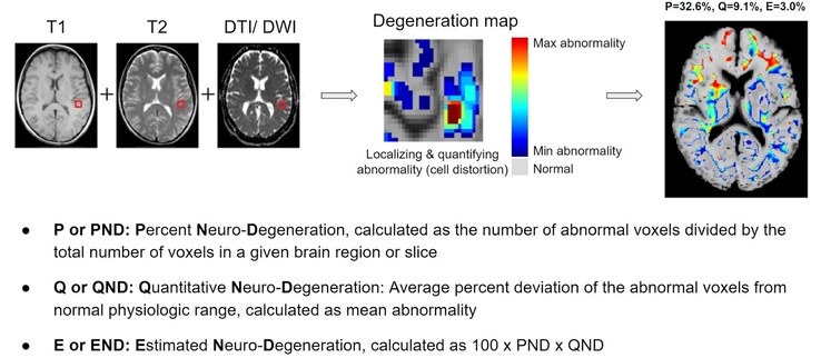 BrainSee può rilevare aree anomale del cervello da una risonanza magnetica e fornire ai medici un punteggio che indica la probabilità che un paziente sviluppi l'Alzheimer. (Fonte: Darmiyan)