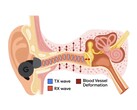 L'APG utilizza toni ultrasonici modulati dalle variazioni di pressione nel canale uditivo (Fonte: Google Research)