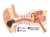 L'APG utilizza toni ultrasonici modulati dalle variazioni di pressione nel canale uditivo (Fonte: Google Research)