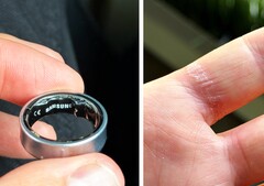 Una batteria gonfia in un anello Galaxy può essere dolorosa (fonte: Zone of Tech)