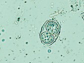 Il Toxoplasma gondii qui mostrato nella sua forma infettiva simile a un uovo. (Fonte: Todorean Gabriel/iStock/Getty Images Plus)