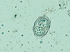 Il Toxoplasma gondii qui mostrato nella sua forma infettiva simile a un uovo. (Fonte: Todorean Gabriel/iStock/Getty Images Plus)