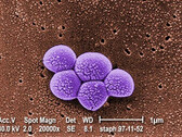 Integrated Biosciences scopre una nuova classe di antibiotici efficaci contro i batteri MRSA resistenti. (Fonte: Public Health Image Library #9994)