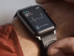 KardiaBand è una fascia per il monitoraggio dell'ECG progettata per l'orologio Apple. (Fonte: Kardia)