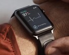 KardiaBand è una fascia per il monitoraggio dell'ECG progettata per l'orologio Apple. (Fonte: Kardia)