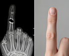 Bone Biologics deposita un brevetto per una nuova tecnologia di rigenerazione ossea (Fonte immagine: immagine illustrativa generata dall'AI)