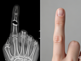 Bone Biologics deposita un brevetto per una nuova tecnologia di rigenerazione ossea (Fonte immagine: immagine illustrativa generata dall'AI)