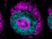Una cellula tumorale confinata (nella foto) - i mitocondri di colore magenta possono essere visti accumularsi alla periferia nucleare di colore ciano e all'interno delle rientranze nucleari. (Fonte immagine/caption: Rito Ghose e Fabio Pezzano/Centro de Regulación Genómica)