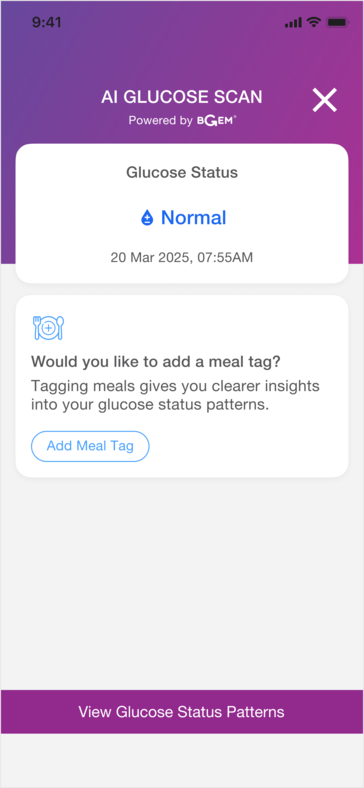 L'anello intelligente potrebbe essere utile per scoprire i legami tra determinati alimenti e il livello di zucchero nel sangue dell'utente