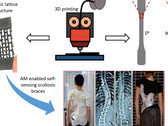 Una nuova ricerca sul trattamento della scoliosi utilizza un tutore intelligente per la schiena stampato in 3D per fissare la postura nei bambini con deformità della colonna vertebrale senza chirurgia