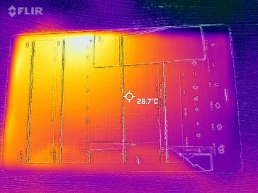 Termografia - parte anteriore