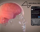 La visione di Neuralink: controllo completo dei dispositivi digitali attraverso il pensiero (Fonte: Neuralink)