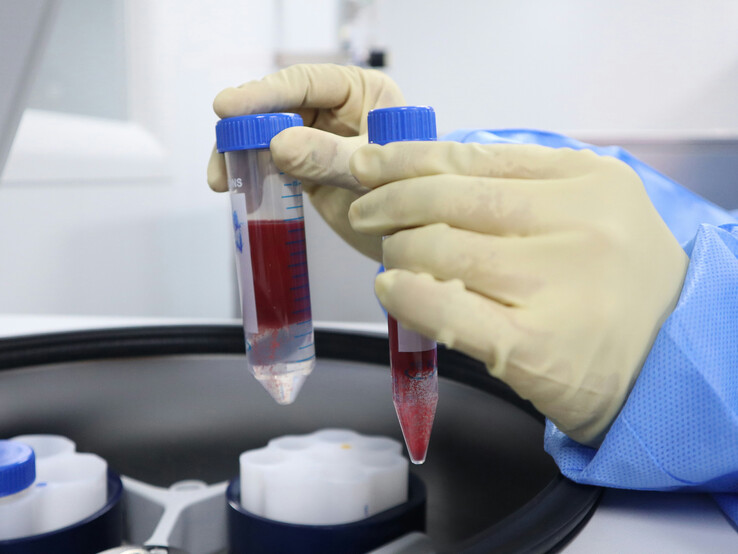 I laboratori di analisi del sangue sono stati tra i servizi dell'NHS disturbati dal cyberattacco alla catena di approvvigionamento di Synnovis (fonte: Unsplash/Malcolm Choong)