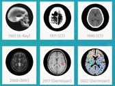 Il software medico AI BrainSee di Darmiyan può rilevare precocemente i segni dell'Alzheimer. (Fonte: Darmiyan)