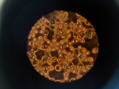 Cellule del sangue al microscopio (Fonte: ThisisEngineering via Unsplash; ritagliato)