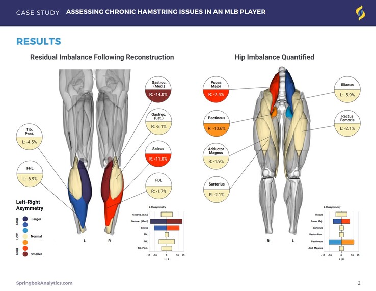 I rapporti di Springbok Analytics dettagliano i singoli muscoli attraverso le scansioni MRI 3D. (Fonte: Springbok Analytics)