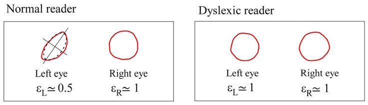 I centroidi di Maxwell differiscono per simmetria nei soggetti normali, ma sono simili nei soggetti dislessici. (Fonte immagine: DOI 10.3390/brainsci13101478) 