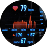 Grafico frequenza cardiaca