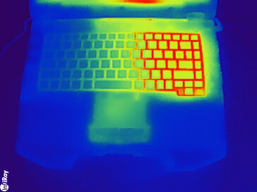 Test da sforzo