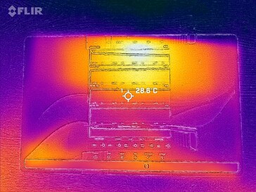 Termografia: frontale