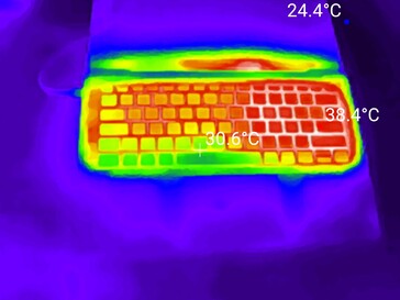 Test da sforzo
