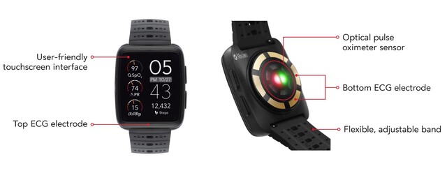 L'orologio Masimo W1 è progettato per il monitoraggio costante della SpO2 e di altri parametri vitali. (Fonte: Masimo)
