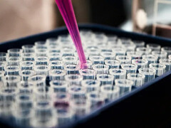Un test rapido del sangue promette risposte più rapide per le famiglie che devono affrontare malattie genetiche rare (Fonte: Louis Reed, Unsplash)